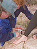 toenail surgery for Marlene